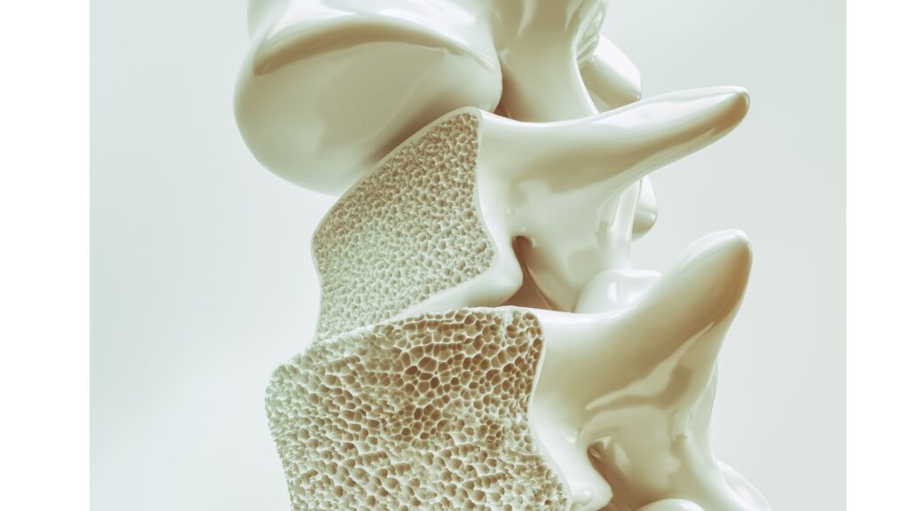 What is osteoporosis -
